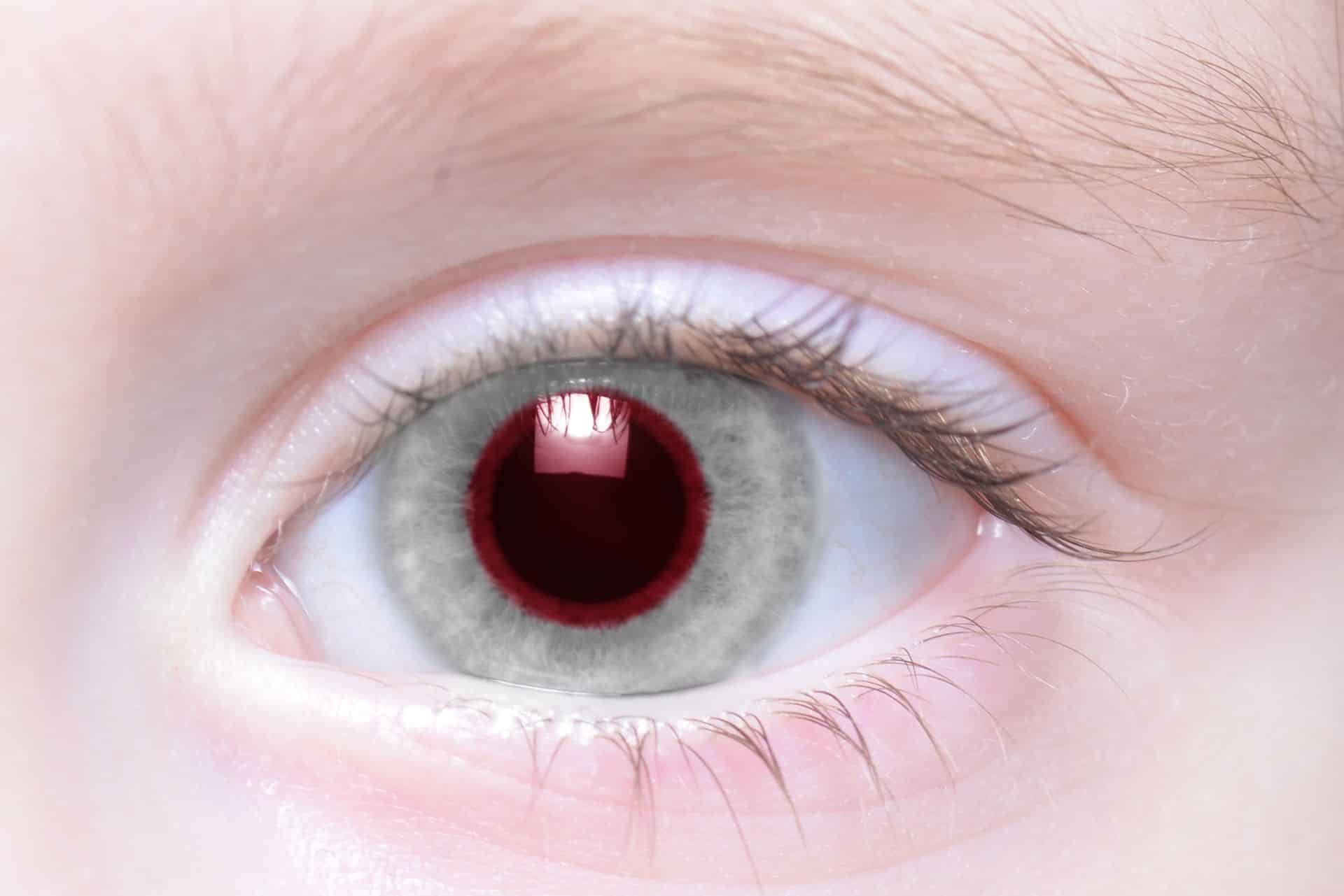 What Causes Red Eyes in Photos?