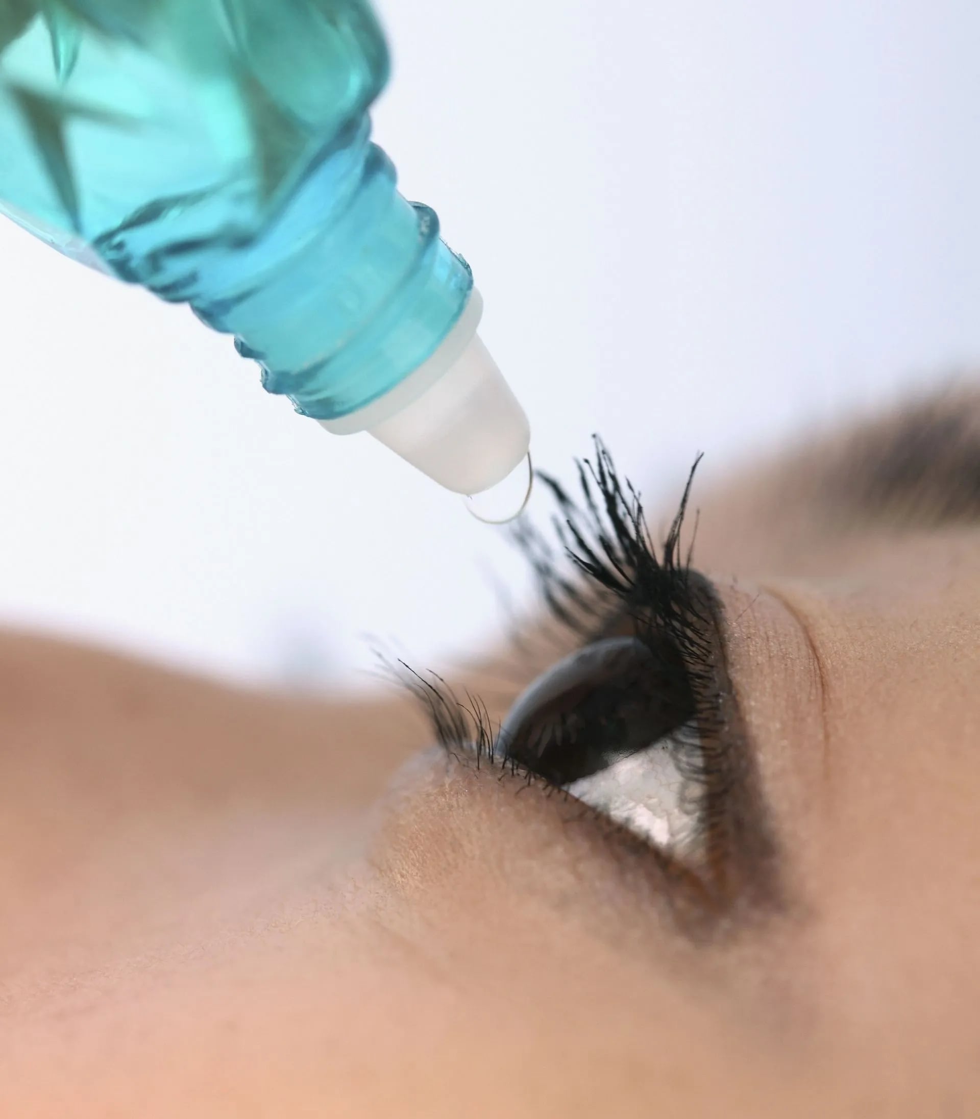 Dry Eyes Brookfield WI